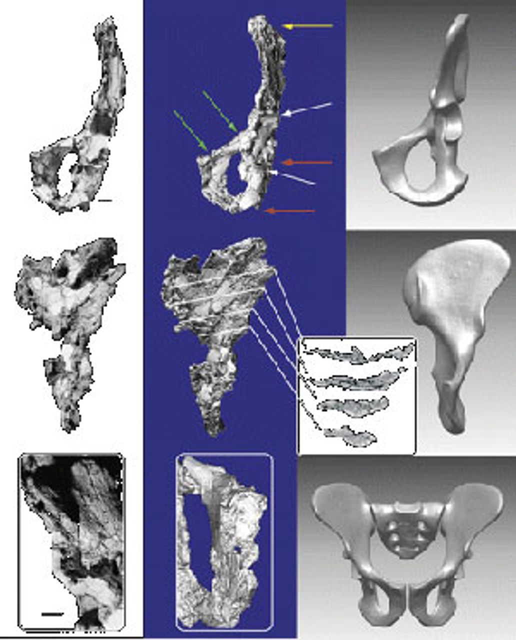 Figure 7. Pelvis of an Ardipithecus specimin